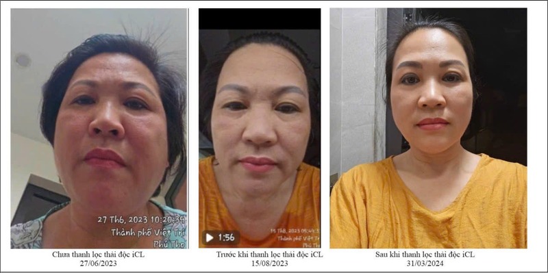 Hành Trình Hồi Sinh Thể Chất và Tinh Thần Sau 7 Ngày Với I Chữa Lành!